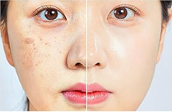 美容液 D.P.L Cell Infusion Program buyKOREA | Korean Supplier Directory & Verified Manufacturers